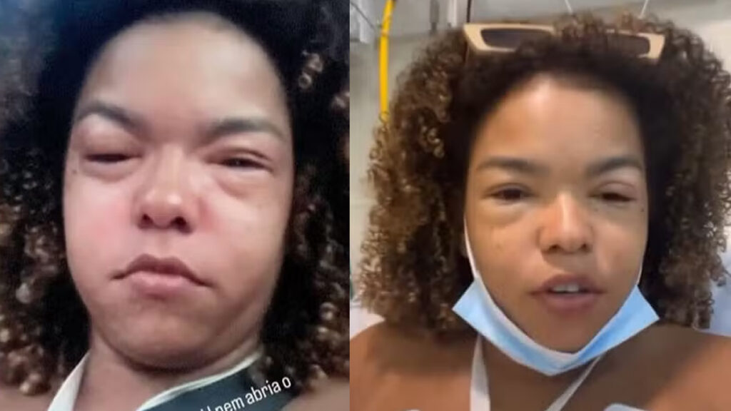 Jeniffer Nascimento surge com o rosto deformado e motivo vem