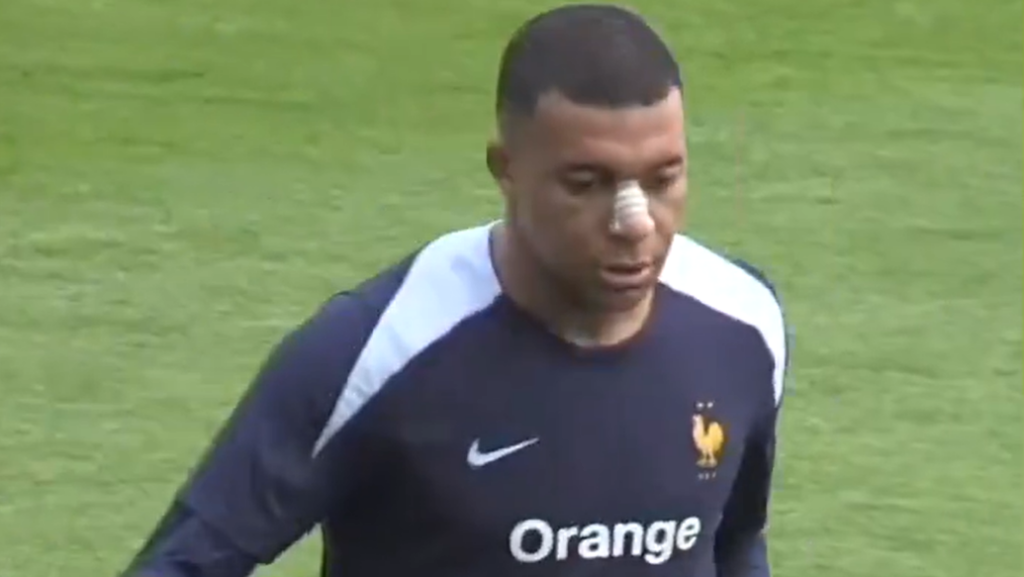 Mbappé usa proteção no nariz em treino da França; veja