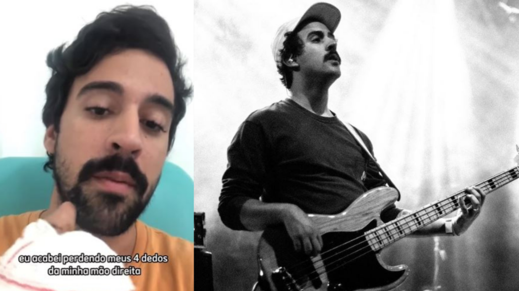 Baixista de banda de rock perde quatro dedos em acidente