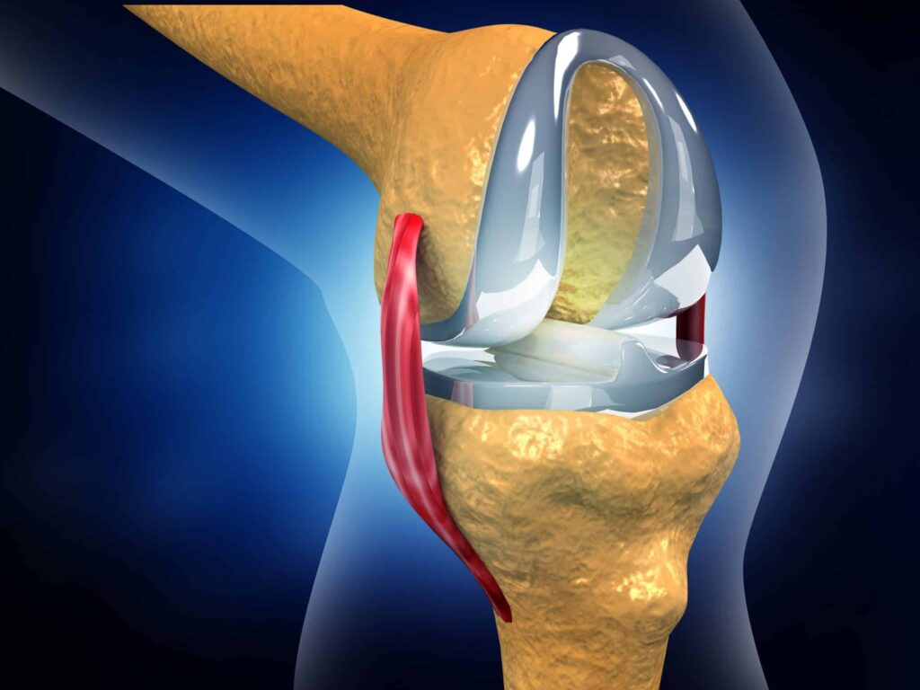 Simples mudança pode tornar implantes de quadril e joelho mais