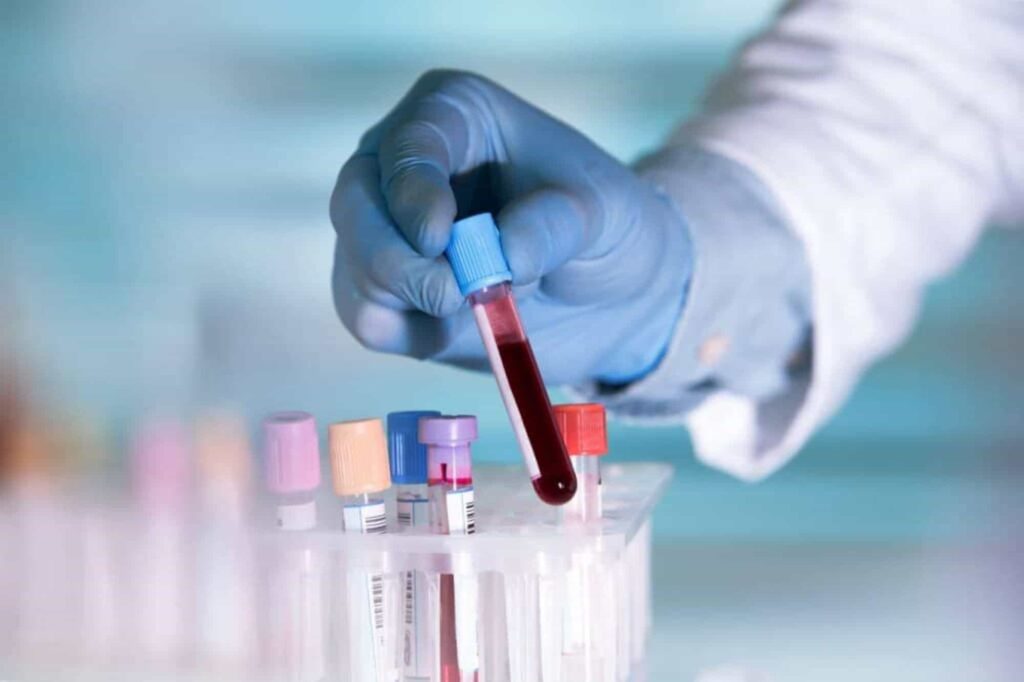 Startup quer cultivar sangue em laboratório; entenda o motivo