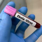 Estudo traz possível tratamento promissor para o vírus Ebola