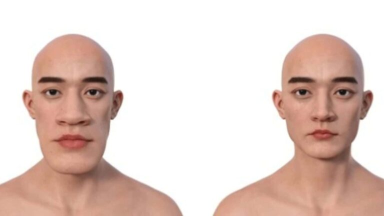 Acromegalia ou gigantismo? Conheça as doenças que fazem o corpo