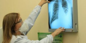 Baixo financiamento mundial ameaça combate à tuberculose