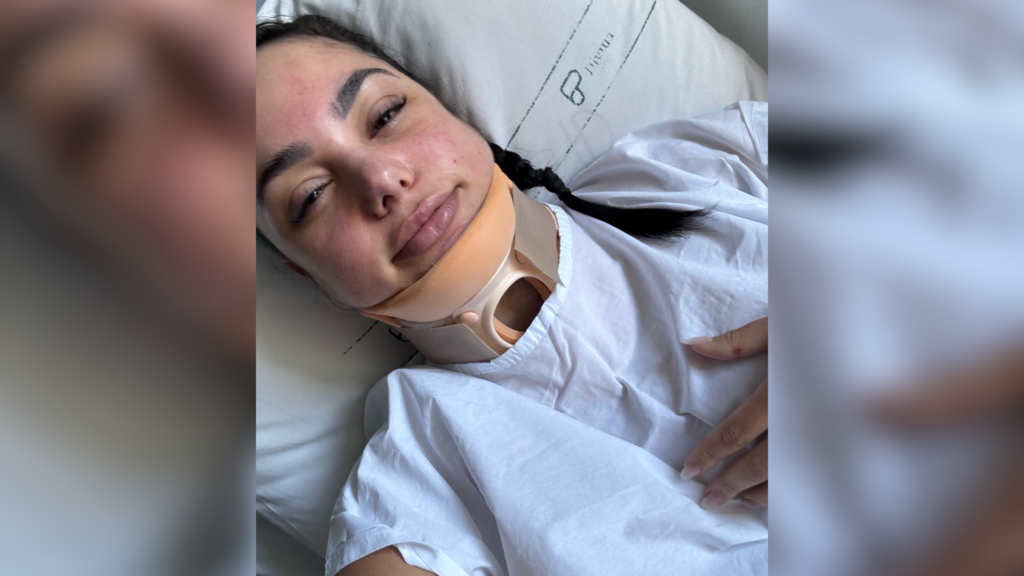Cabelo preso em piscina: entenda como mulher sobreviveu após quebrar