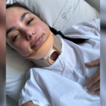 Cabelo preso em piscina: entenda como mulher sobreviveu após quebrar