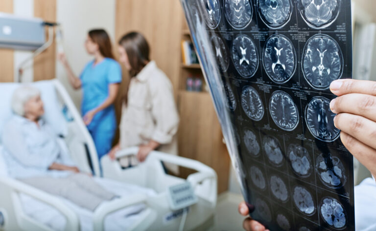 Alzheimer afeta número recorde de pessoas nos EUA