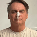 Bolsonaro deixa UTI após duas semanas internado