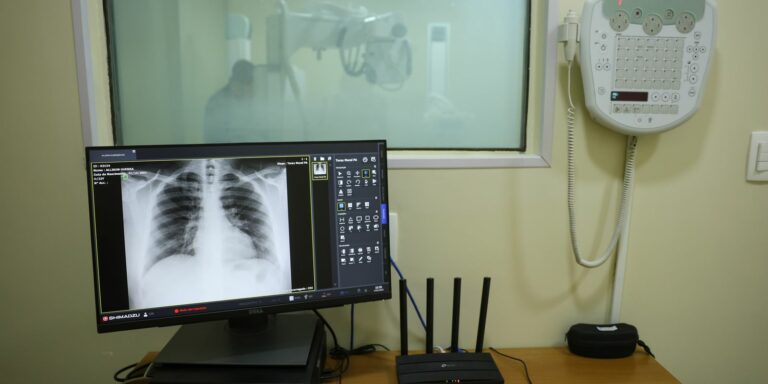 Brasil tem aumento de hospitalizações por Influenza A, alerta Fiocruz