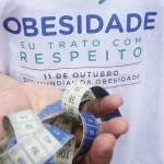 Adolescentes a partir dos 14 anos podem fazer cirurgia bariátrica