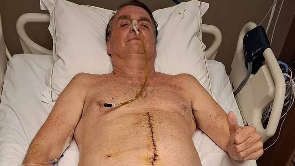Bolsonaro deixa UTI, mas segue internado sem previsão de alta