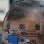 Tatuagem eletrônica monitora o cérebro e pode prever burnout