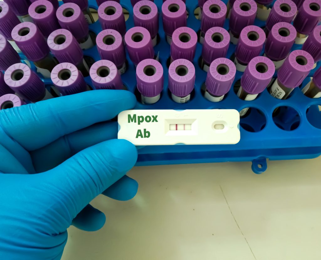 Casos de Mpox crescem e OMS mantém estado de emergência