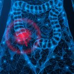 Este câncer tem aumentado entre jovens e intriga médicos