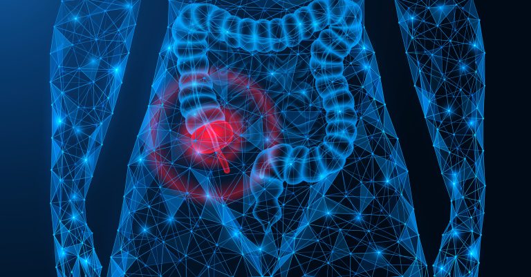 Este câncer tem aumentado entre jovens e intriga médicos
