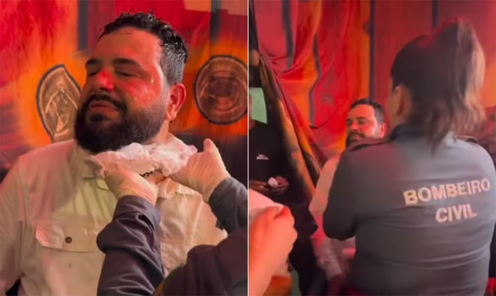 Léo Oliveira, sertanejo que teve rosto queimado no palco desabafa: