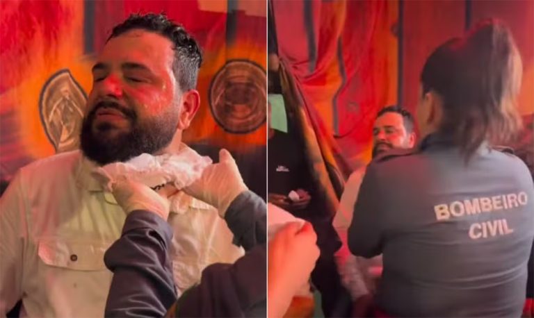 Léo Oliveira, sertanejo que teve rosto queimado no palco desabafa: