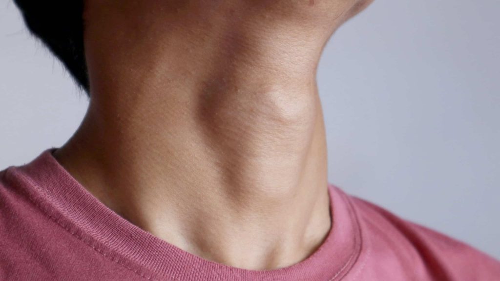 Por que sentimos o famoso “nó na garganta”? A medicina