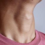 Por que sentimos o famoso “nó na garganta”? A medicina
