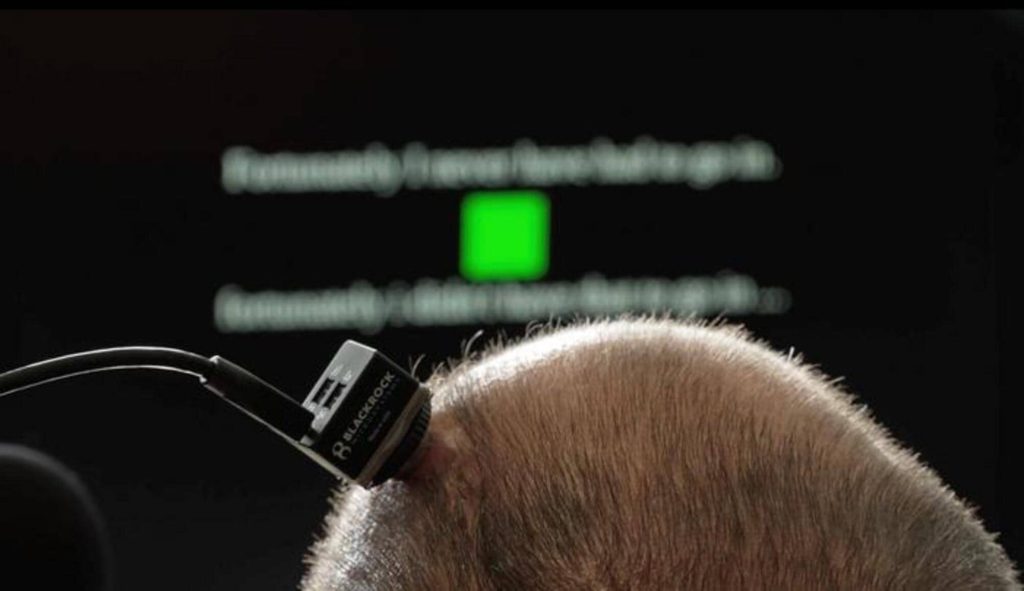 Tecnologia recria voz de pessoas que não conseguem falar