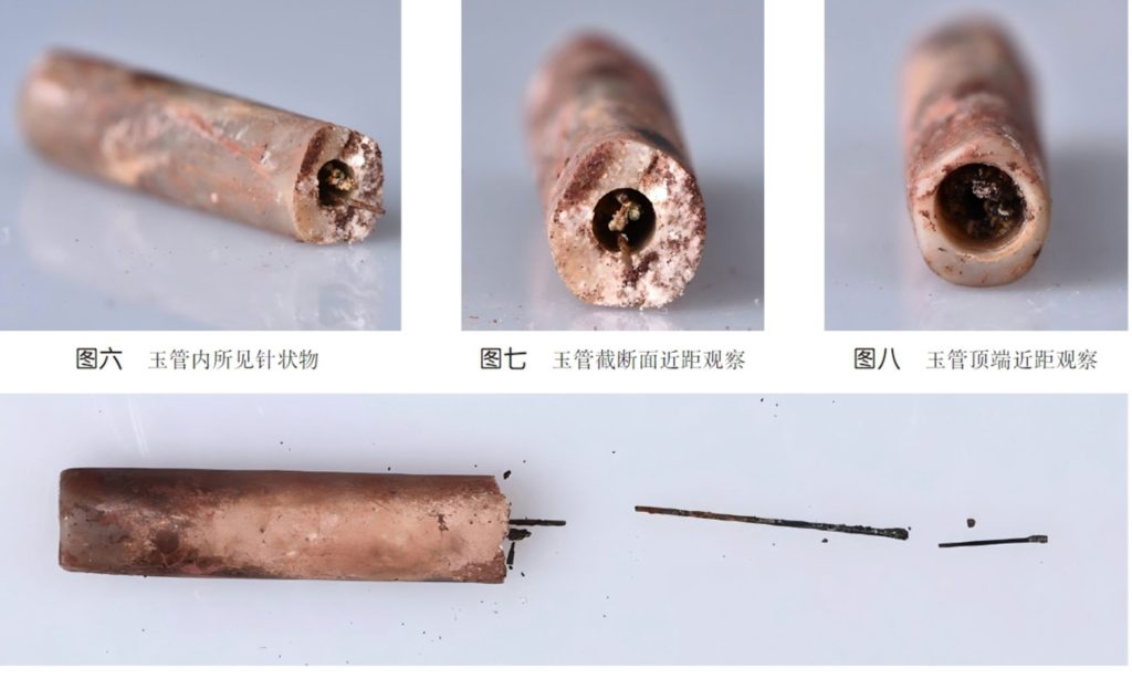 Arqueólogos encontram agulhas médicas de 2 mil anos na China