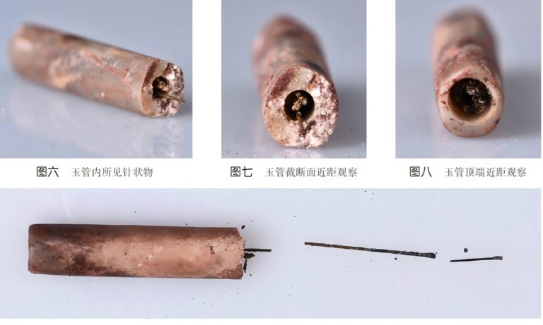Arqueólogos encontram agulhas médicas de 2 mil anos na China
