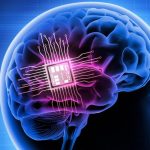 Chips cerebrais: Neuralink pode ganhar concorrente de peso
