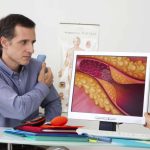 Como funcionam os minirrobôs que desentopem artérias
