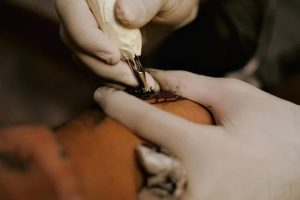 Conselho Federal de Medicina proíbe uso de anestesia em tatuagem