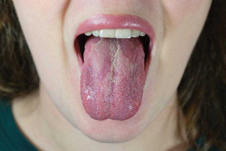 Mais que sentir gosto: a língua pode indicar se sua