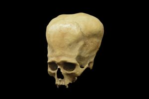 Misterioso crânio de “alien” encontrado na Argentina é desvendado