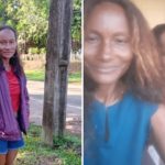 Morre mulher que teve 90% do corpo queimado pelo marido