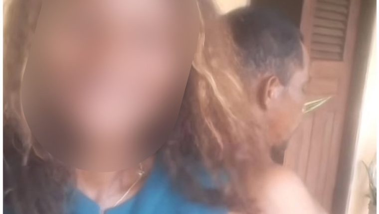 Mulher tem 90% do corpo queimado na Baixada Maranhense