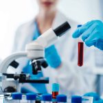 Novo exame antecipa diagnóstico da esclerose múltipla em até três