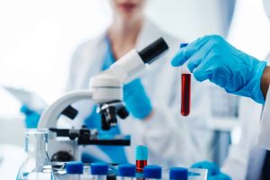 Novo exame antecipa diagnóstico da esclerose múltipla em até três