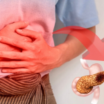 Quais os sintomas do câncer de pâncreas? Conheça a doença