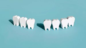 Esse segredo centenário pode manter os dentes saudáveis