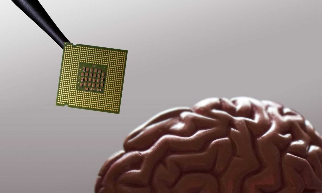 Implante cerebral pode ler pensamentos e transformá-los em texto