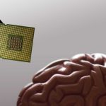 Implante cerebral pode ler pensamentos e transformá-los em texto