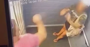 Mulher espancada pelo ex em elevador reconstrói face em cirurgia