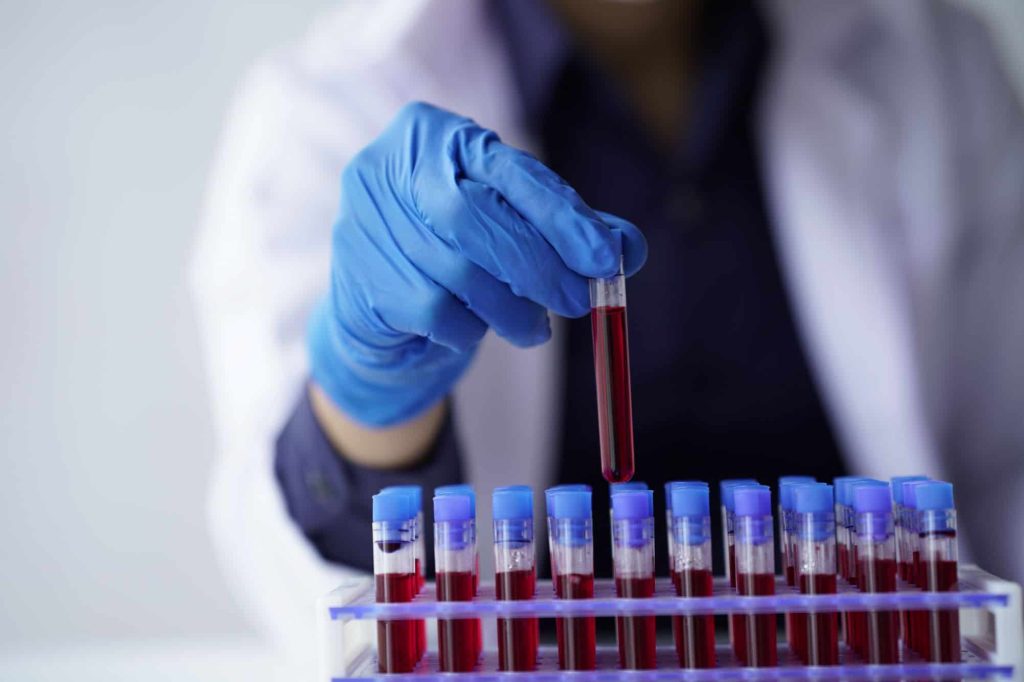 Pesquisadores descobrem possível elo entre sangue e rejuvenescimento