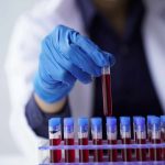 Pesquisadores descobrem possível elo entre sangue e rejuvenescimento