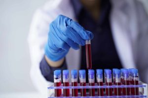 Pesquisadores descobrem possível elo entre sangue e rejuvenescimento