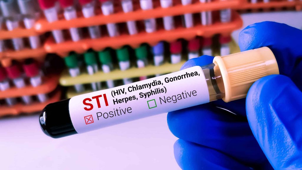 7 ISTs perigosas, mas com sintomas silenciosos
