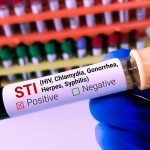 7 ISTs perigosas, mas com sintomas silenciosos