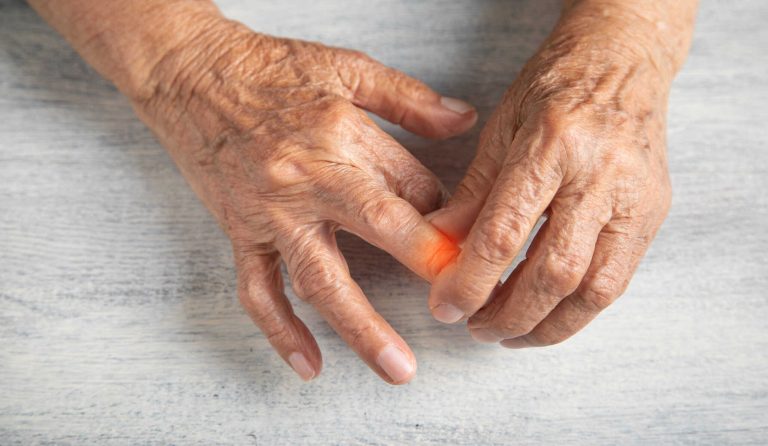 Cartilagem artificial pode aliviar sintomas da artrite