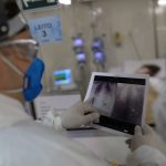 Covid é principal causa de internação por síndrome respiratória no