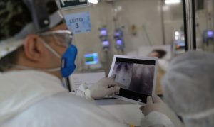 Covid é principal causa de internação por síndrome respiratória no