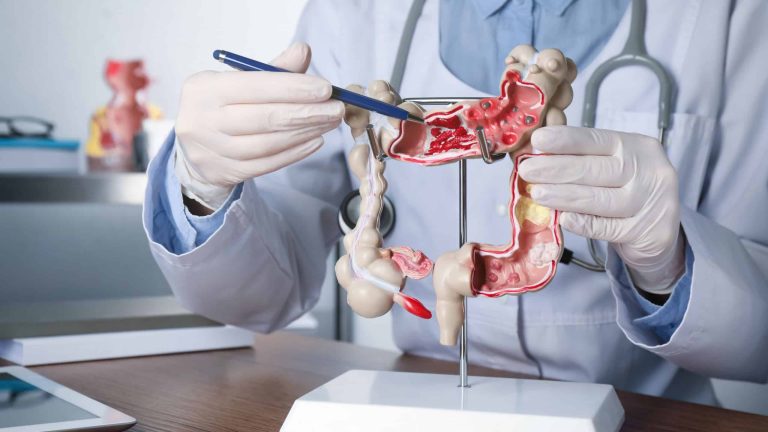 Estes hábitos podem reduzir em até 30% o risco de