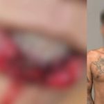Homem é preso após atacar namorada e arrancar parte da